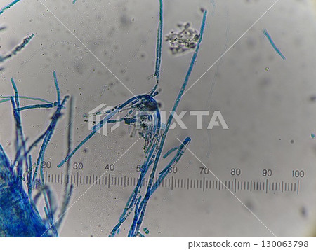 Appearance of mycelium stained with cotton blue Appearance of mycelium stained with cotton blue 130063798