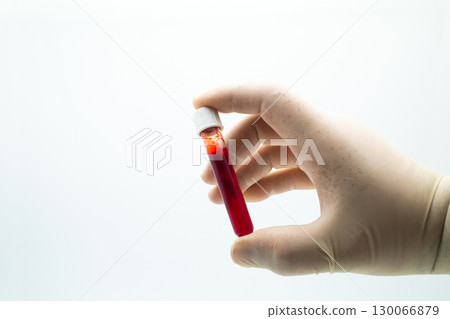 Laboratory Technician Examining Blood Sample Vial Against White Background 130066879