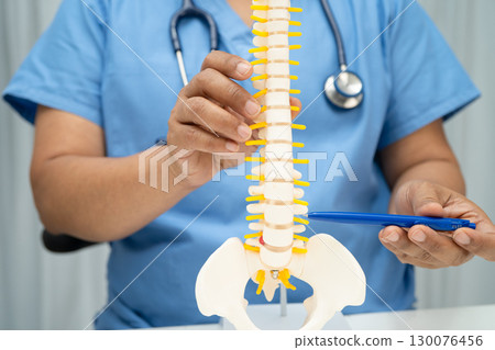 Doctor with lumbar vertebra bone skeleton and nerve model for treatment in the orthopedic department. Doctor with lumbar vertebra bone skeleton and nerve model for treatment in the orthopedic department. 130076456