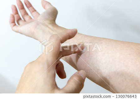 Applying ointment to the sweat rash Applying ointment to the sweat rash 130076643