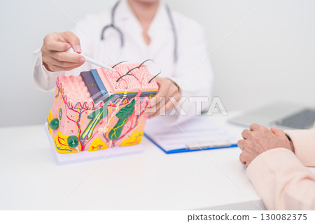 woman Patient consultation Dermatologist with anatomy of skin and hair. Skin disease and Hair loss, Systemic Lupus Erythematosus or SLE, world lupus day, May Melanoma and Skin Cancer Awareness month woman Patient consultation Dermatologist with anatomy of skin and hair. Skin disease and Hair loss, Systemic Lupus Erythematosus or SLE, world lupus day, May Melanoma and Skin Cancer Awareness month 130082375