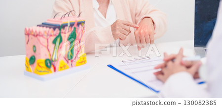 woman Patient consultation Dermatologist with anatomy of skin and hair. Skin disease and Hair loss, Systemic Lupus Erythematosus or SLE, world lupus day, May Melanoma and Skin Cancer Awareness month 130082385