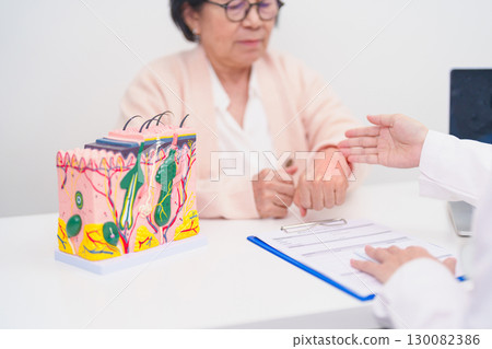 woman Patient consultation Dermatologist with anatomy of skin and hair. Skin disease and Hair loss, Systemic Lupus Erythematosus or SLE, world lupus day, May Melanoma and Skin Cancer Awareness month 130082386