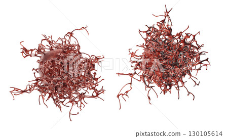 Cervical cancer cells 130105614