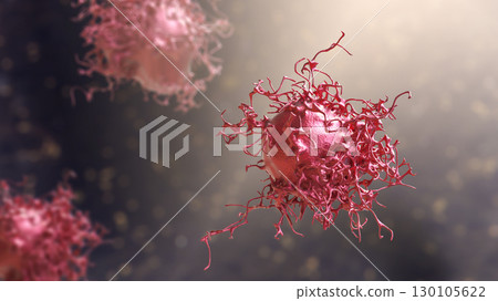 Cervical cancer cells 130105622