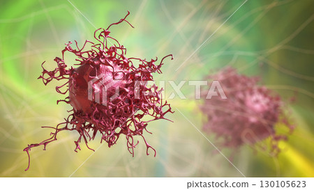 Cervical cancer cells Cervical cancer cells 130105623