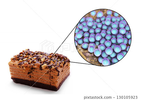 Food borne infections, medical concept 130105923