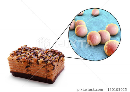 Food borne infections, medical concept 130105925