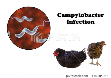 Chicken as the source of Campylobacter infection 130105936