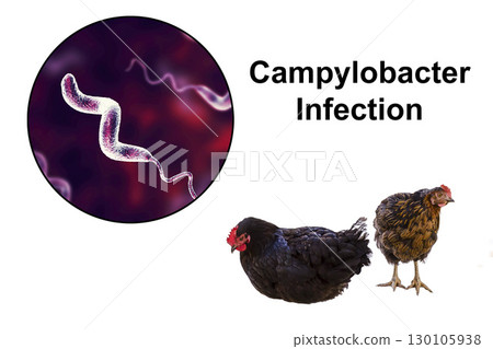 Chicken as the source of Campylobacter infection 130105938