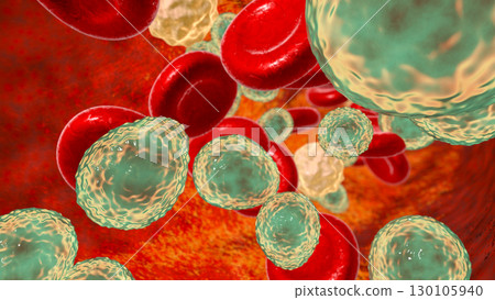 Fungemia, systemic fungal infection, Candida fungi in blood 130105940