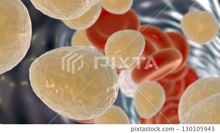 Fungemia, systemic fungal infection, Candida fungi in blood 130105943