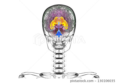 Enlarged lateral ventricles of the brain, 3D illustration Enlarged lateral ventricles of the brain, 3D illustration 130106035