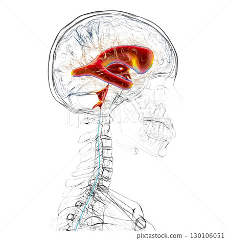Normal pressure hydrocephalus, 3D illustration Normal pressure hydrocephalus, 3D illustration 130106051