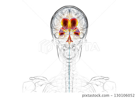 Normal pressure hydrocephalus, 3D illustration 130106052