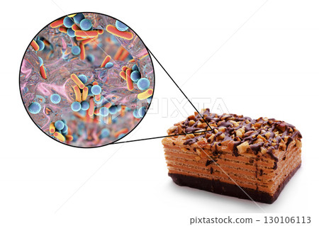 Food borne infections, medical concept 130106113