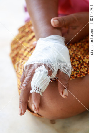 Hand of woman injured and bandaged Hand of woman injured and bandaged 130144701
