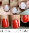 Female hand with red manicure, before and after result, nail design, christmas manicure 130159582