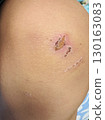 A child's knee with a scab 130163083