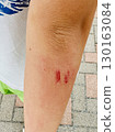 Abraded arm 130163084
