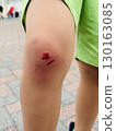 The knee of a child who fell 130163085