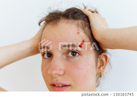 wound blood face woman 130163745