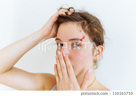 wound blood face woman 130163750