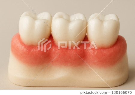 Periodontal disease: Red, swollen gums and gums 130166070