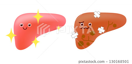 Healthy vs. unhealthy liver 130168501
