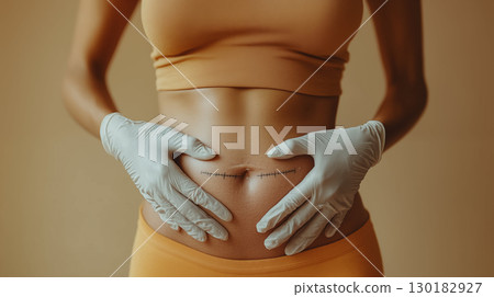 Close-Up of Woman Post-Surgery With Stomach Stitches 130182927
