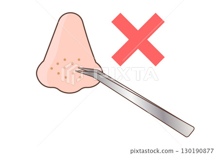 Illustration of removing blackheads with tweezers - Wrong care Illustration of removing blackheads with tweezers - Wrong care 130190877