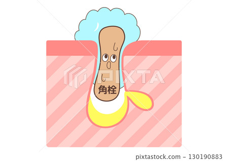 洗臉時出現黑頭的卡通風格橫斷面圖 130190883