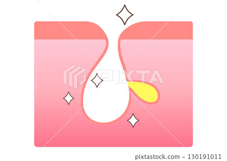 Clean pores: Cross-section of pores after blackhead removal 130191011