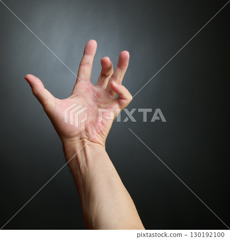 Hand of an man with Dupuytren contracture disease, 130192100