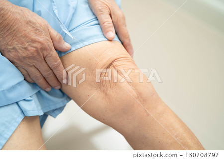 Asian elderly woman patient with scar knee replacement surgery in hospital. 130208792