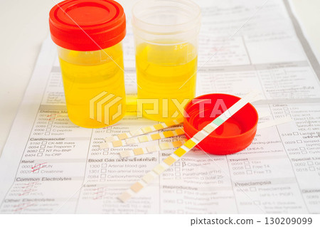 Urinalysis, urine cup for check health examination in laboratory. Urinalysis, urine cup for check health examination in laboratory. 130209099