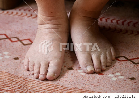 老人的腳 130215112