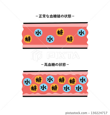 血糖正常和血糖高的血管對比圖 130224717