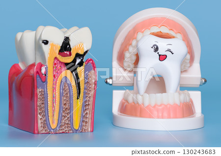 dental model showing severe tooth decay beside a smiling winking tooth inside a set of artificial gums 130243683