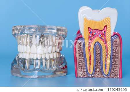 Dental jaw model with implants and healthy tooth anatomy model Dental jaw model with implants and healthy tooth anatomy model 130243693