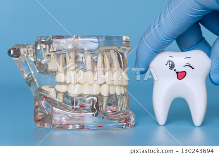 Model of a jaw with implants and a winking tooth Model of a jaw with implants and a winking tooth 130243694