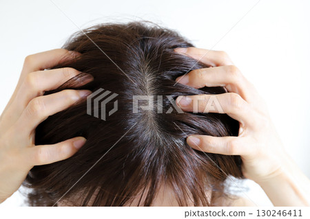 女性頭皮和皮膚 女性頭皮和皮膚 130246411