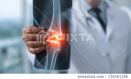 close up of doctor hand holding knee x ray film with light behind close up of doctor hand holding knee x ray film with light behind 130261296