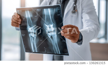 orthopedic expert holding x ray sheet of knee bones in clinic 130261315