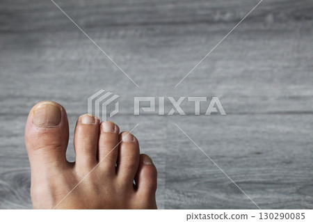 Toes on a gray background with space for copyspace text 130290085