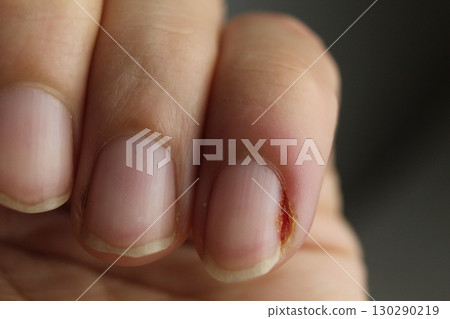Close-up of a woman's hand nails without manicure. Clean hands Close-up of a woman's hand nails without manicure. Clean hands 130290219