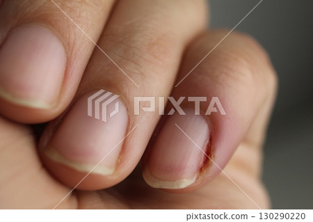 Clean short fingernails close-up. Preparation for manicure 130290220