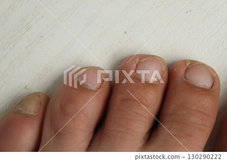 Toes close-up. Toenail care, pedicure Toes close-up. Toenail care, pedicure 130290222