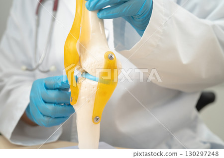 Osteoarthritis of the knee, Doctor holding human knee joint orthopedic anatomy model in hospital. Osteoarthritis of the knee, Doctor holding human knee joint orthopedic anatomy model in hospital. 130297248
