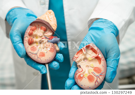 Kidney disease, Chronic kidney disease ckd, Doctor hold human model to treat and study in hospital. Kidney disease, Chronic kidney disease ckd, Doctor hold human model to treat and study in hospital. 130297249